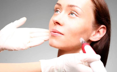 What is Microneedling?
