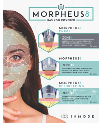 Morpheus8 Pic